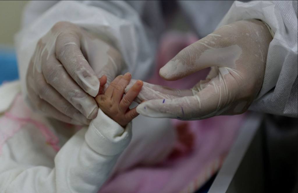 A Gaza, il n'y a plus «de bébés de taille normale», s'insurge un responsable de l'ONU