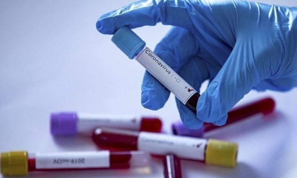 Algérie : de nouveaux cas de Covid ces dernières 24 heures