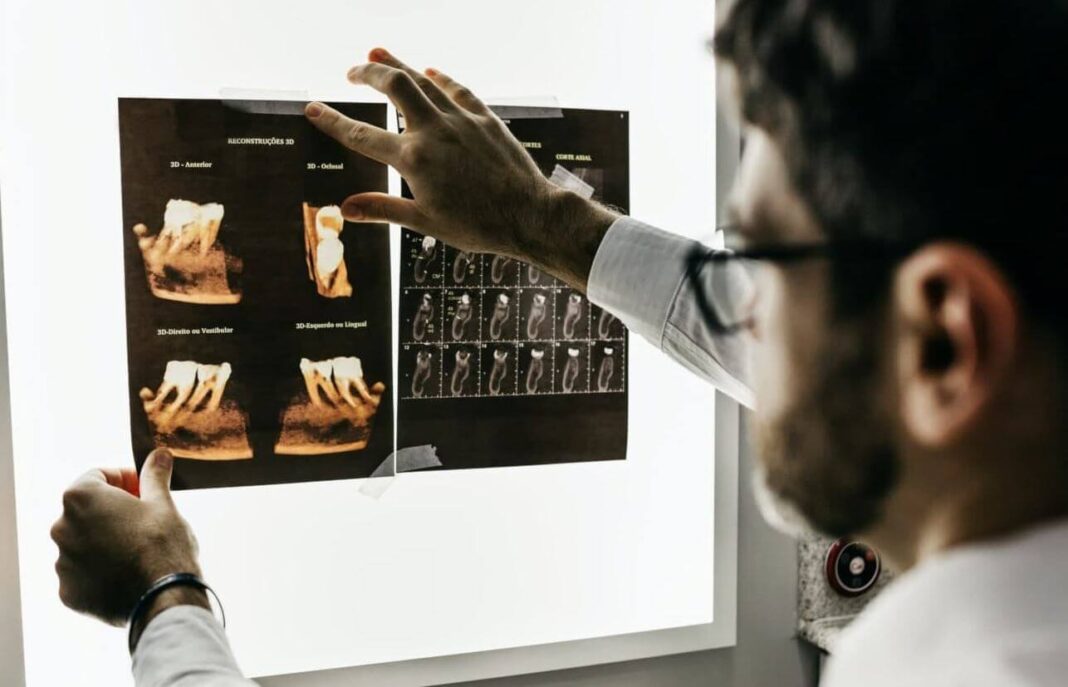 Faire repousser les dents : des chercheurs japonais ont trouvé un traitement